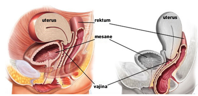 Vajinoplasti Sonrası Dikişler Ne Zaman İyileşir?